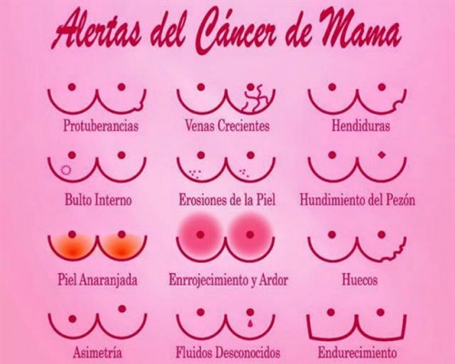 alertas cáncer de mama
